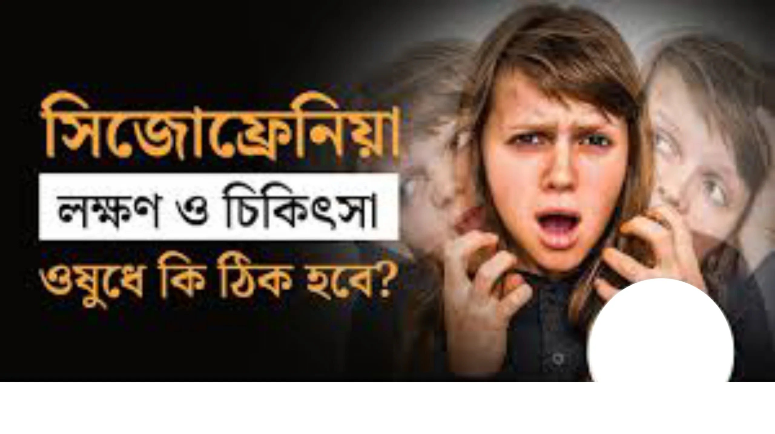 সিজোফ্রেনিয়া কি পুরোপুরি ভালো হয়? লক্ষণ, কারণ ও আধুনিক চিকিৎসা নিয়ে বিস্তারিত